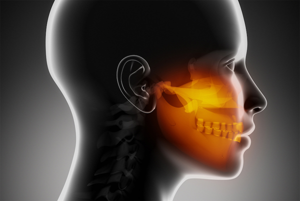 Jaw Cyst and Tumor