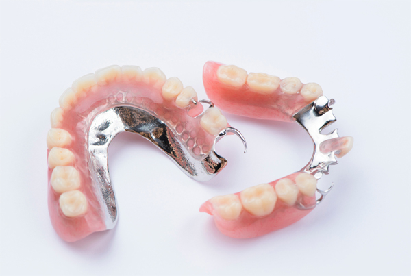 Cast Partial Dentures