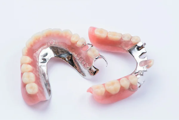 Cast Partial Dentures