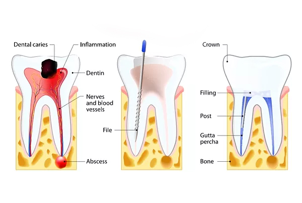 Conservative Dentistry