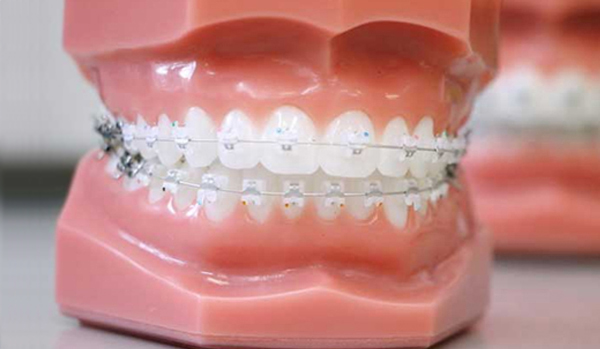 Orthodontics